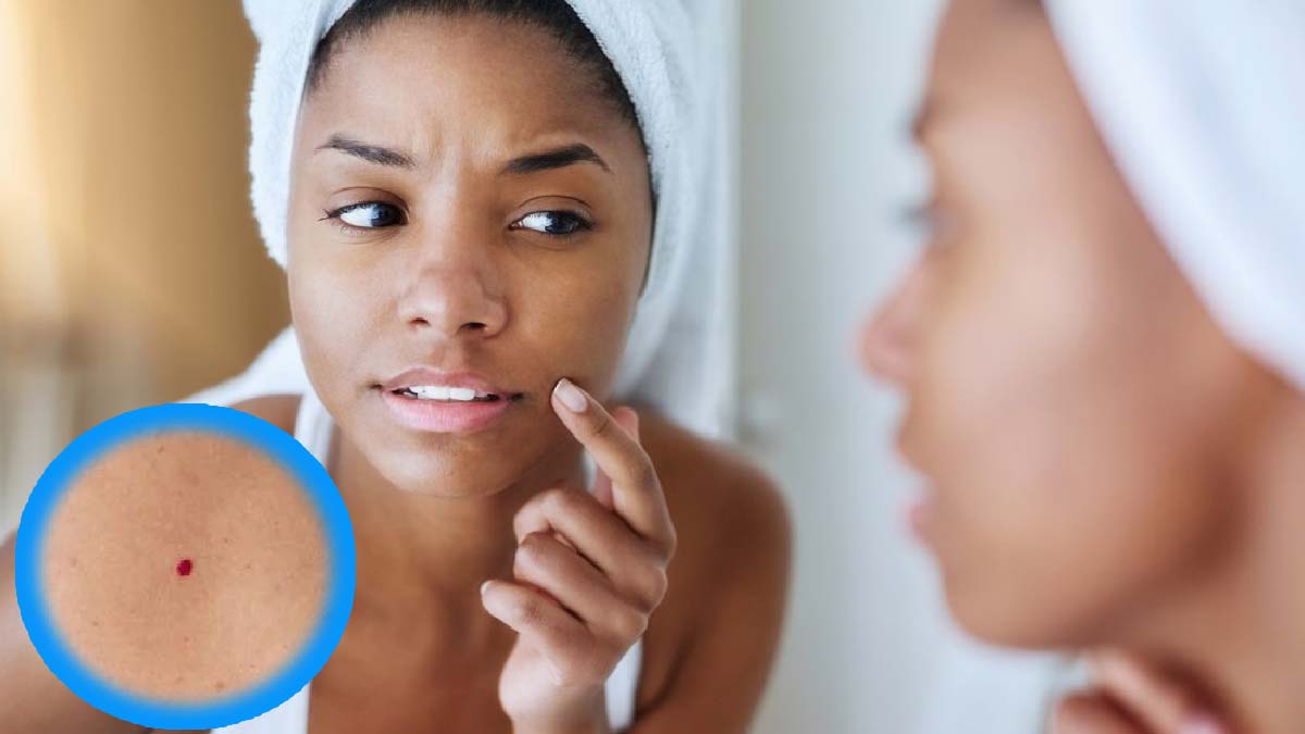 Pourquoi ai-je des points rouges sur la peau ? – Douce Beauty